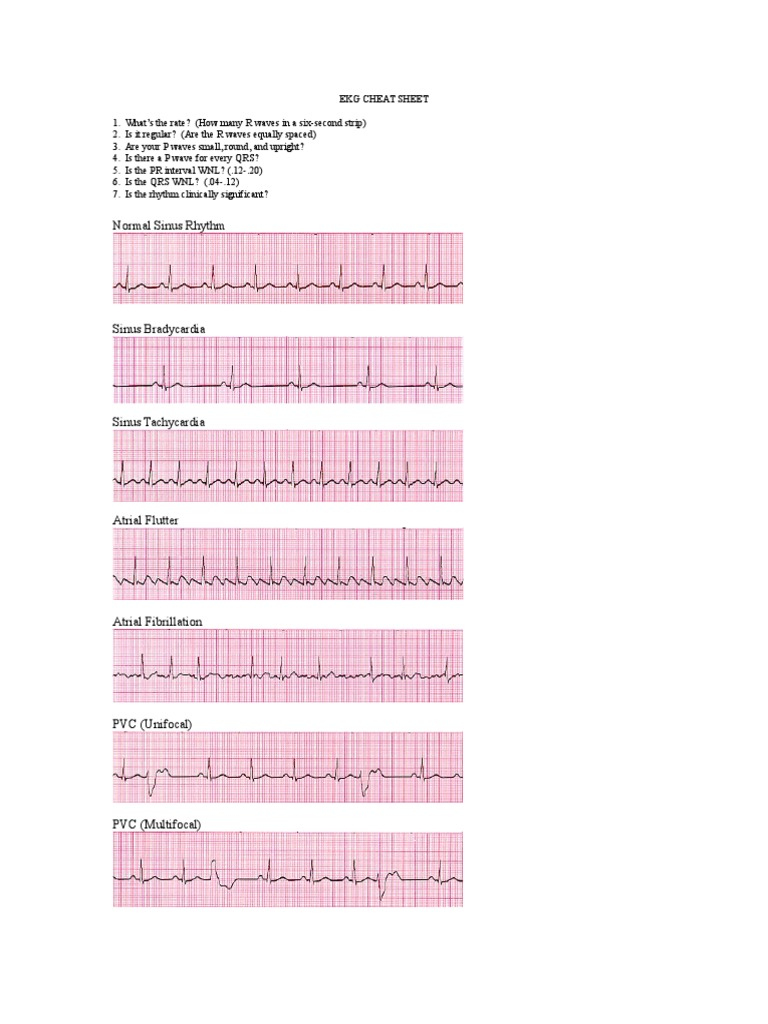 EKG Interpretation Cheat Sheet PDF EKG Interpretation Cheat Sheet PDF