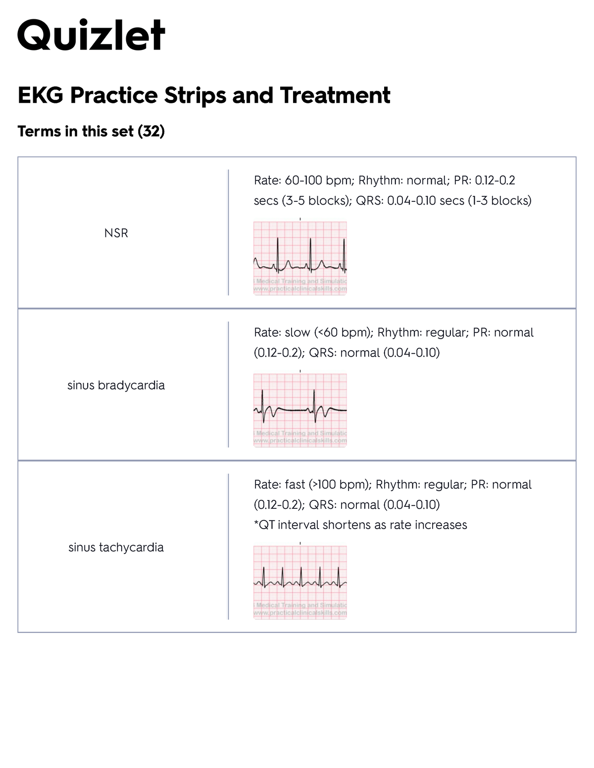 EKG Practice Strips and Treatment Flashcards Quizlet - EKG EKG Practice Strips and Treatment Flashcards Quizlet - EKG